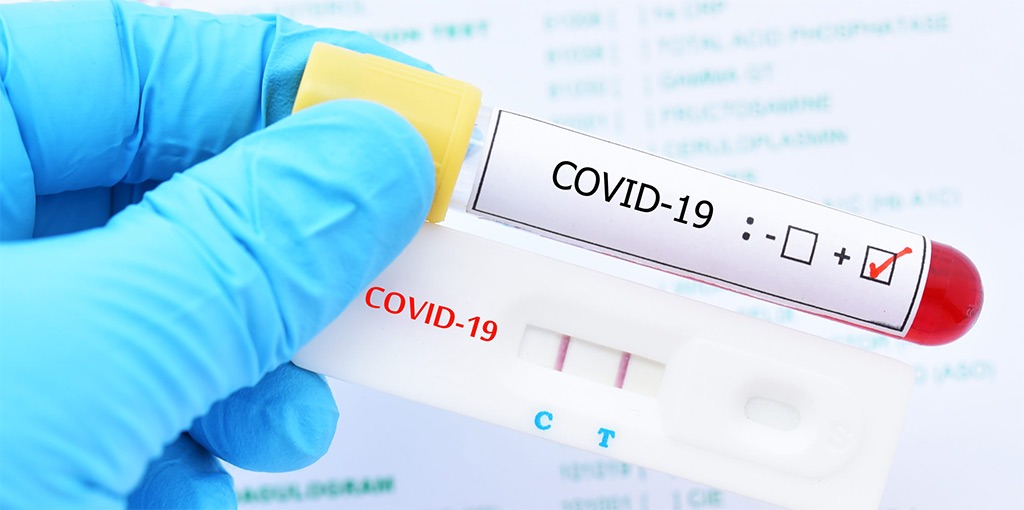 Medicare Payment Amounts for New COVID-19 Tests